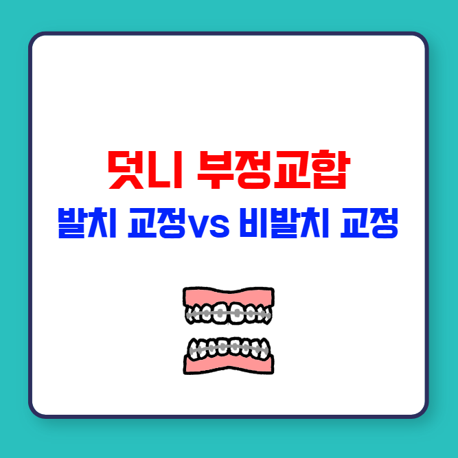 덧니 부정교합 발치 교정 vs 비발치 교정 장단점 비교