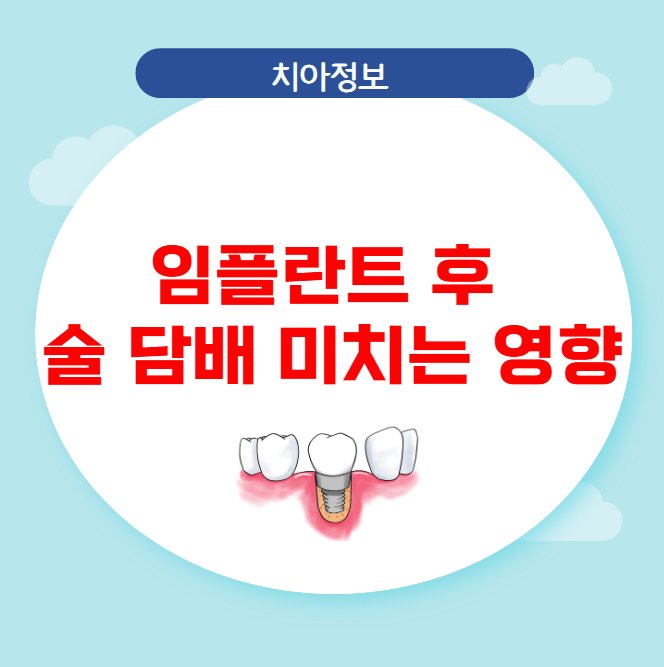 임플란트 후 술 담배 미치는 영향 임플란트 후 술 담배 미치는 영향