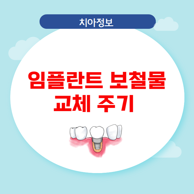 임플란트 보철물 교체 주기 관리법