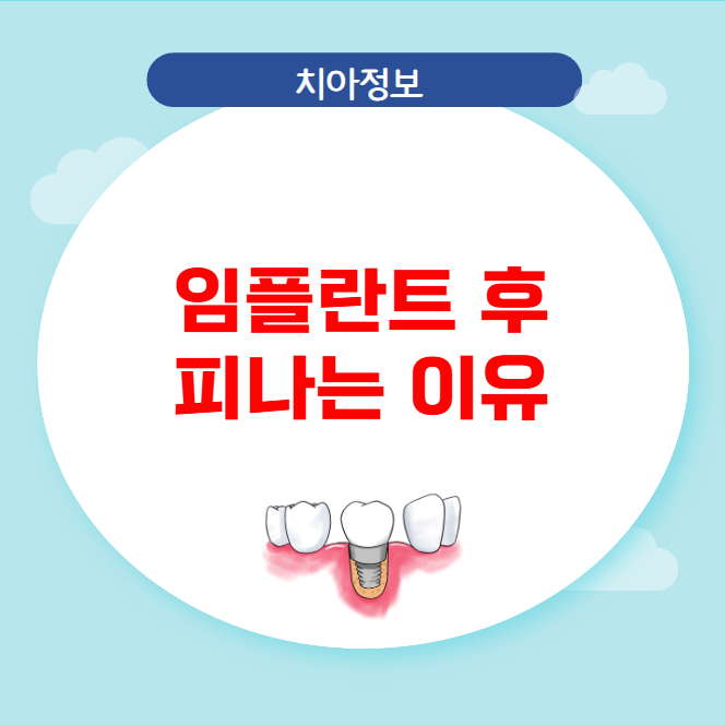 임플란트 후 피나는 이유