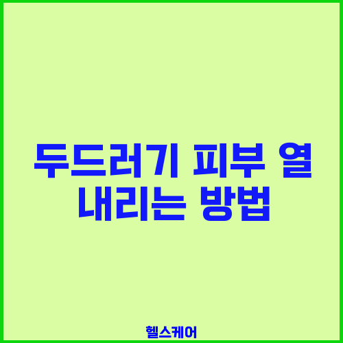 두드러기 피부 열 내리는 방법