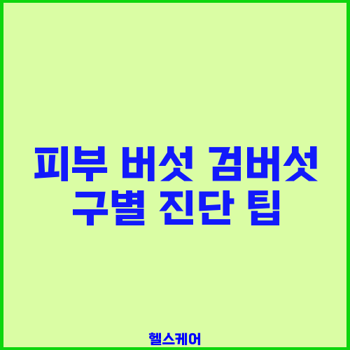 피부 버섯 검버섯 구별 진단 팁
