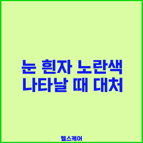눈 흰자 노란색 나타날 때 대처